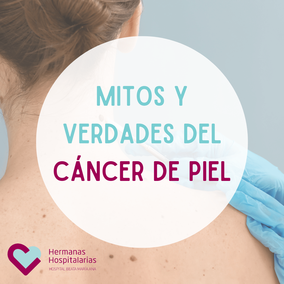 Mitos y realidades del cáncer de piel